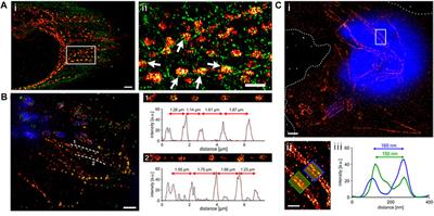 Visualizing the invisible: novel approaches to visualizing bacterial proteins and host-pathogen interactions